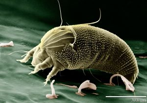 Dust Mite Under a Microscope